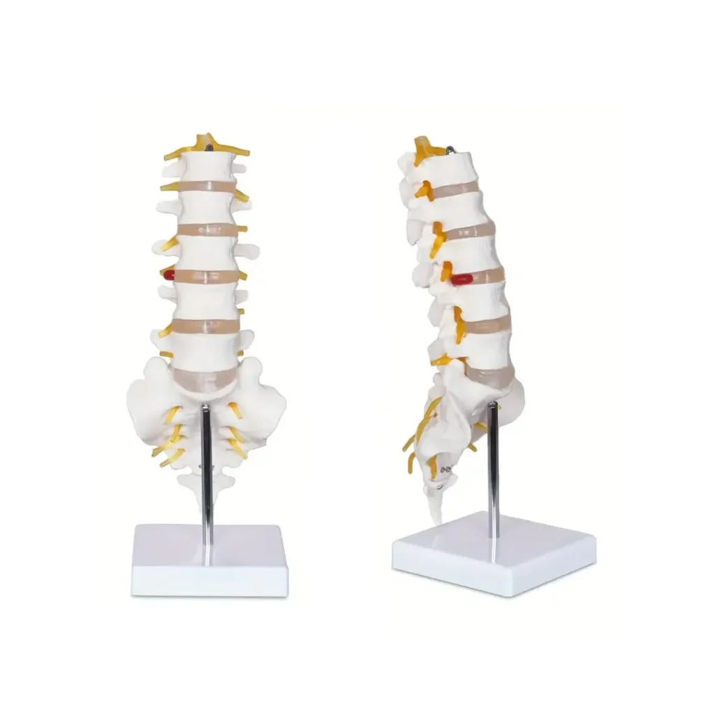 Lumbal coloumna - anatomisk modell